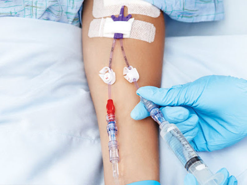 Damardan Serum Tedavisi Uygulama