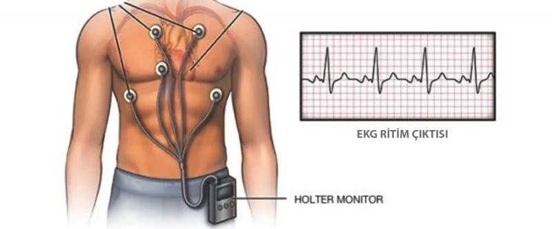 Ritm Holter Tetkiki